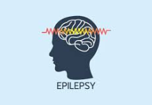 Experts seek greater awareness, treatment access for epilepsy