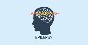 Experts seek greater awareness, treatment access for epilepsy