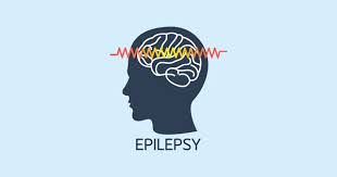 Experts seek greater awareness, treatment access for epilepsy