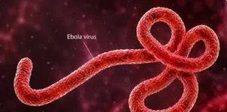 Weak surveillance, research gaps driving persistent Ebola outbreaks — Expert
