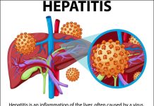 Kwara inaugurates roadmap to eliminate viral hepatitis